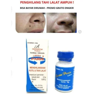 Swiss Paris Lotion Penghilang Tahi Lalat & Kutil Original – Obat Oles Aman & Terdaftar BPOM